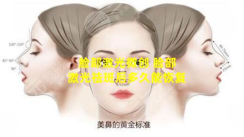 脸部激光微创 脸部激光祛斑后多久能恢复